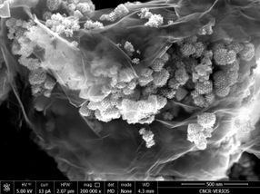 For a longer battery life: Pushing lithium ion batteries to the next performance level