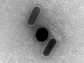 Energy transmission by gold nanoparticles coupled to DNA structures